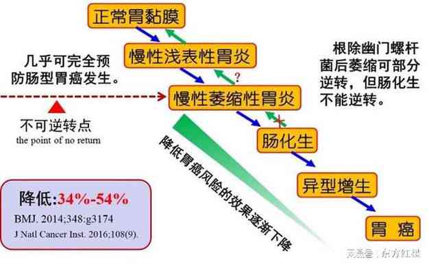 急性胃炎：它是否属于急性疾病及其相关症状、成因与治疗全面解析
