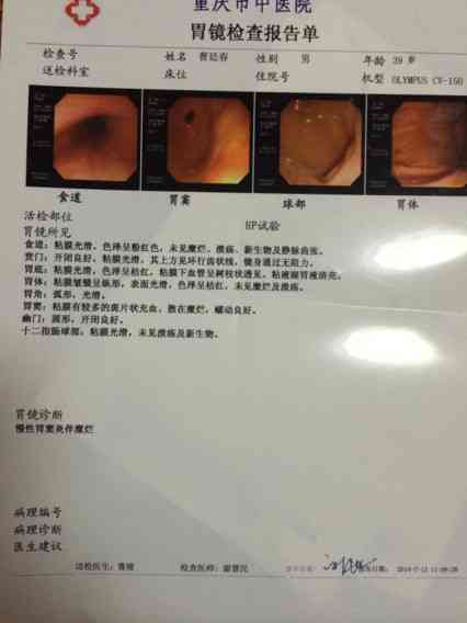 急性胃炎算重病吗：是重大疾病还是急性疾病，严重性解析