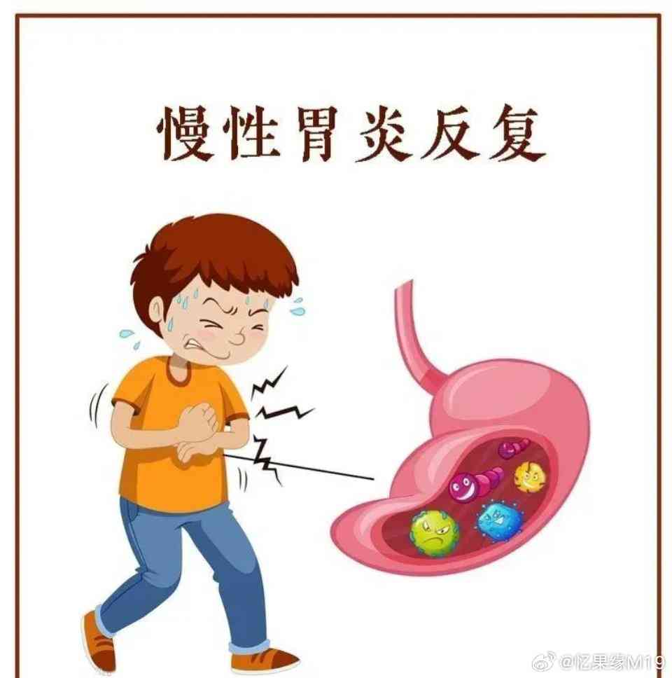 急性胃炎是否属于重大疾病：症状、影响及分类解析