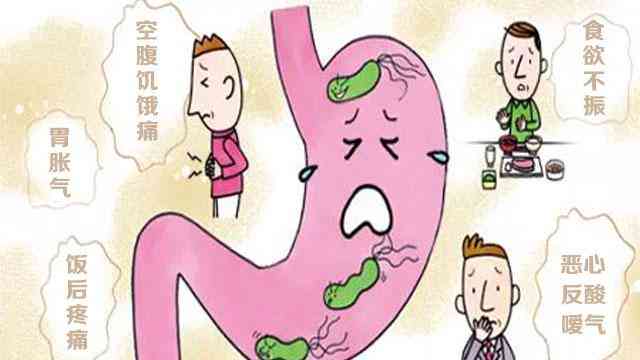 急性胃炎是否属于重大疾病：症状、影响及分类解析