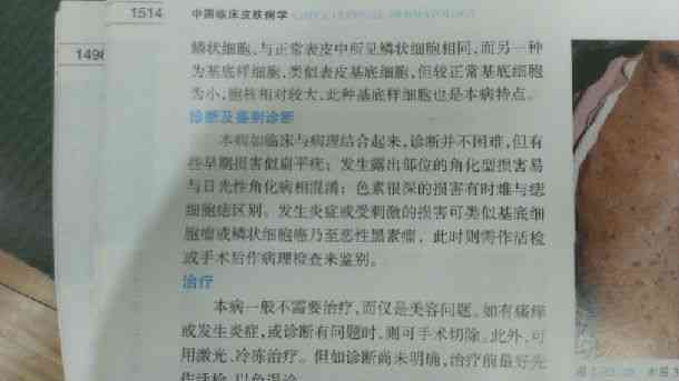 急性肠胃炎是否可认定为职业性疾病：探讨工伤界定新标准