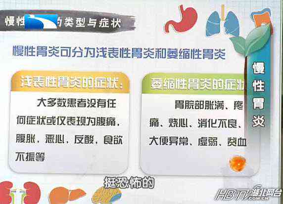 急性胃炎是否属于重大疾病及其对健的影响解读