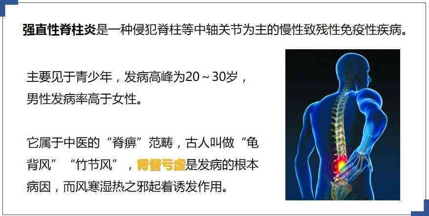 急性脊柱炎能治好吗：性别不限，治愈费用解析与治疗详情