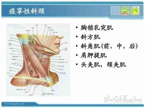 探索急性脊柱炎：有效治疗方法与治愈可能性分析