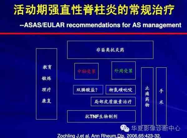 探索急性脊柱炎的治愈可能性与有效治疗策略