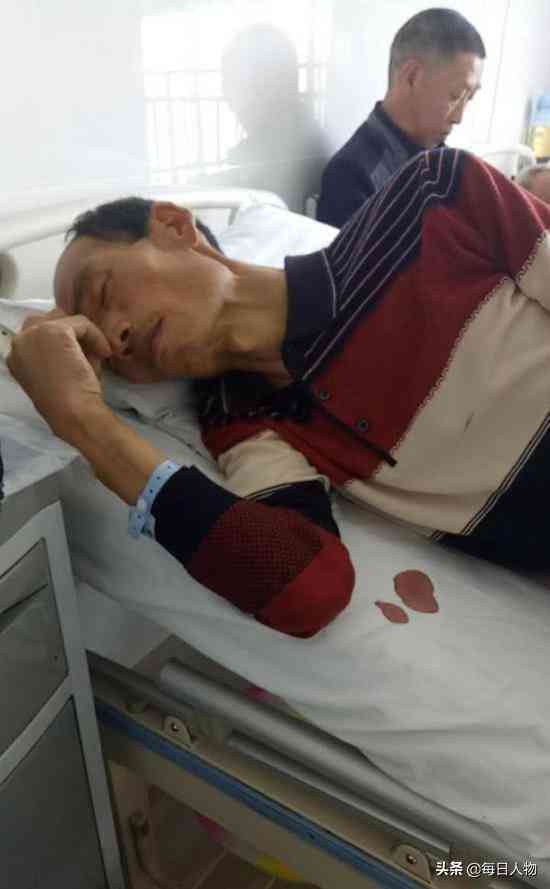 肝癌能否被认定为工伤：详解相关法律法规与认定条件