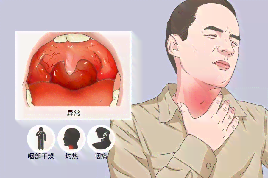 慢性咽炎怎么认定工伤