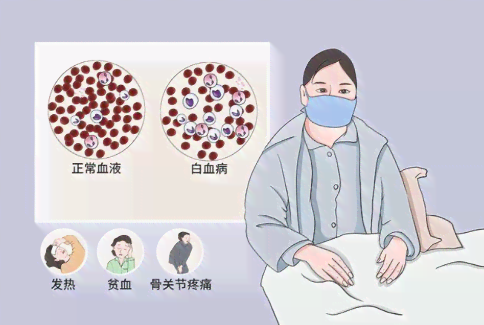 慢性白血病病患是否合办理病退条件解析