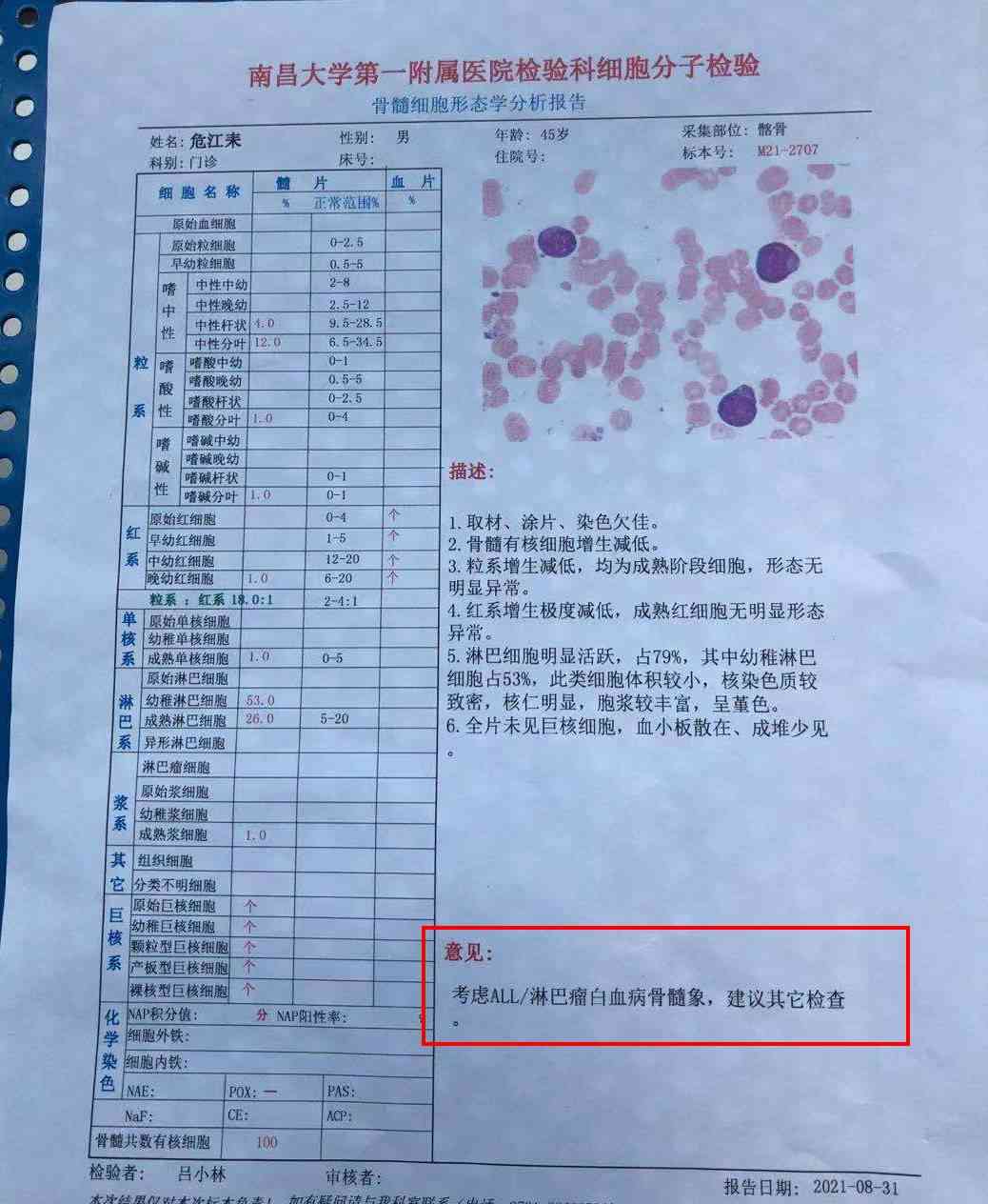 慢性白血病病患是否合办理病退条件解析