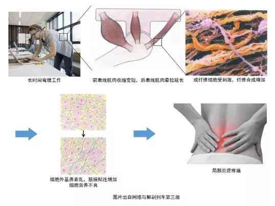 慢性筋膜炎在工作环境下致伤，能否被认定为工伤情形？