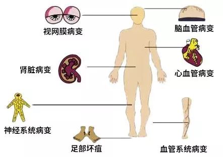 得了慢性筋膜炎是不是废人，如何正常生活与复？