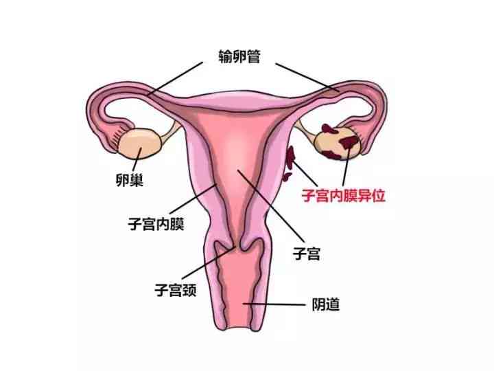 探讨慢性筋膜炎自愈的可能性与促进自愈的方法