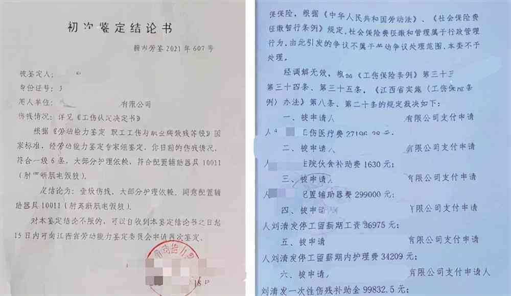 截肢工伤：赔偿标准、工伤等级划分及公司赔付额度解析与抑预防