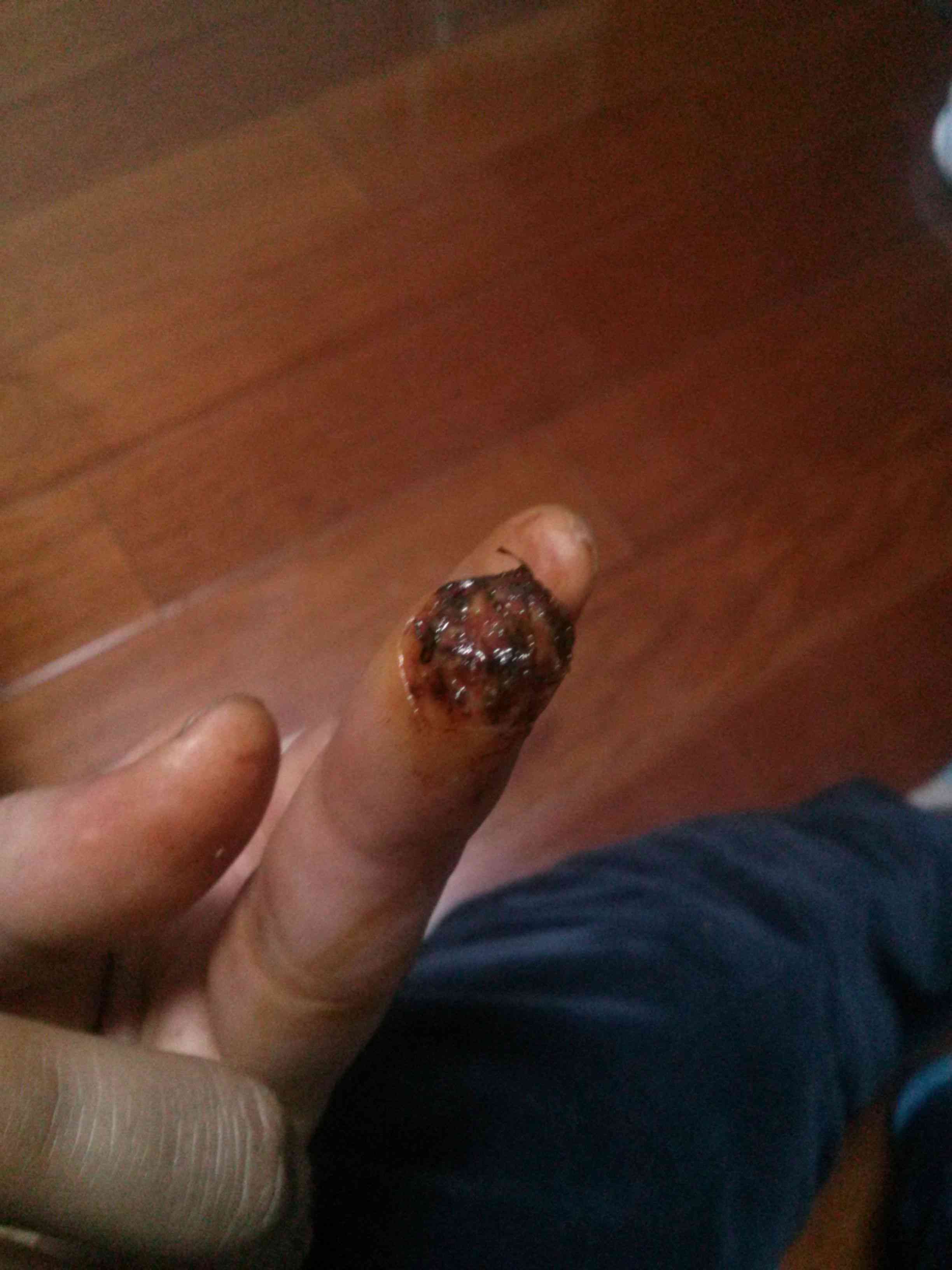 手划伤能认定工伤吗