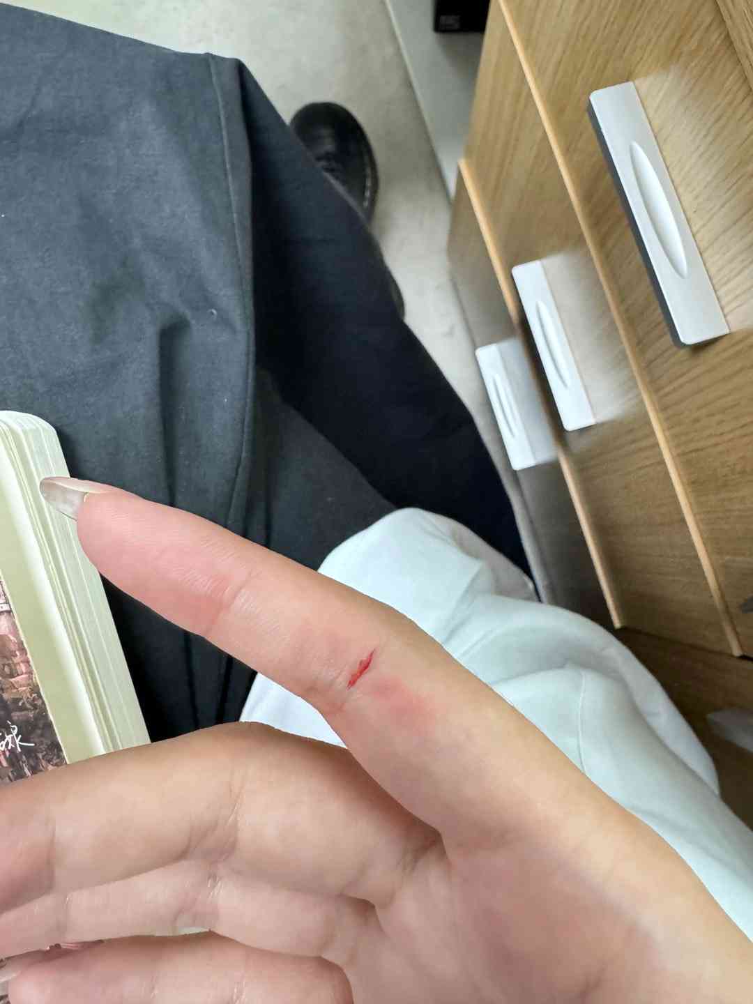 手划破可以认定工伤吗