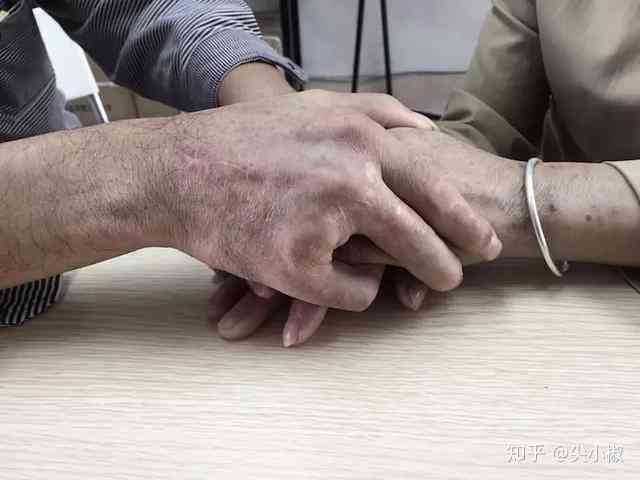 手割破可以认定工伤吗 手割破可以认定工伤吗