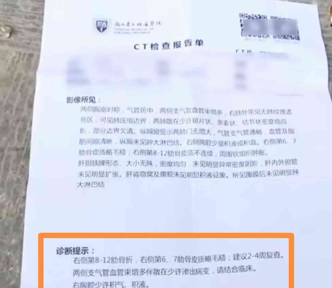 手干扭伤能认定工伤吗怎么赔偿：工伤认定及赔偿金额解析