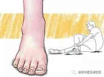 手扭伤后的工作影响与恢复建议：如何合理安排工作与复