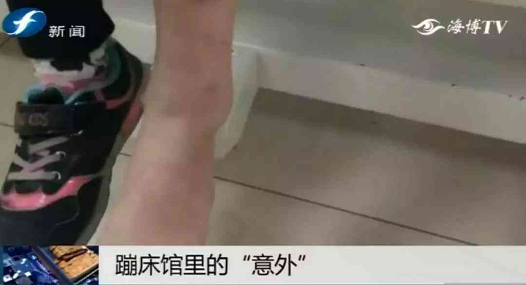 '手部创伤诊断：手打石膏确认骨折还是断裂情况'