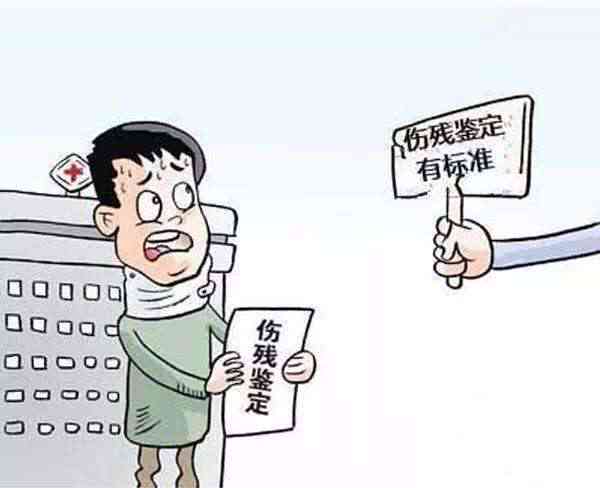 手指受伤工伤鉴定标准及伤残等级划分详解