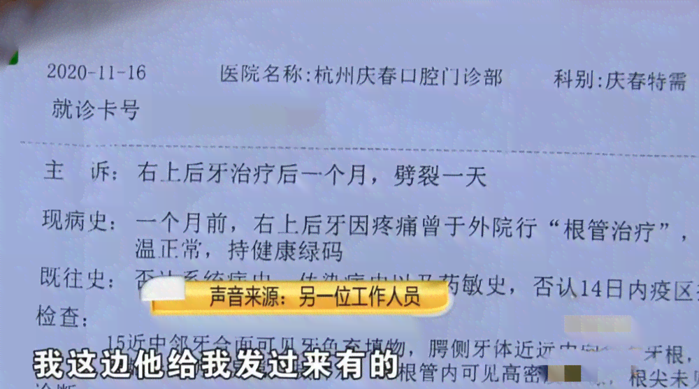 手指截了一节如何赔偿：手指截掉一节伤残等级及赔付标准解析