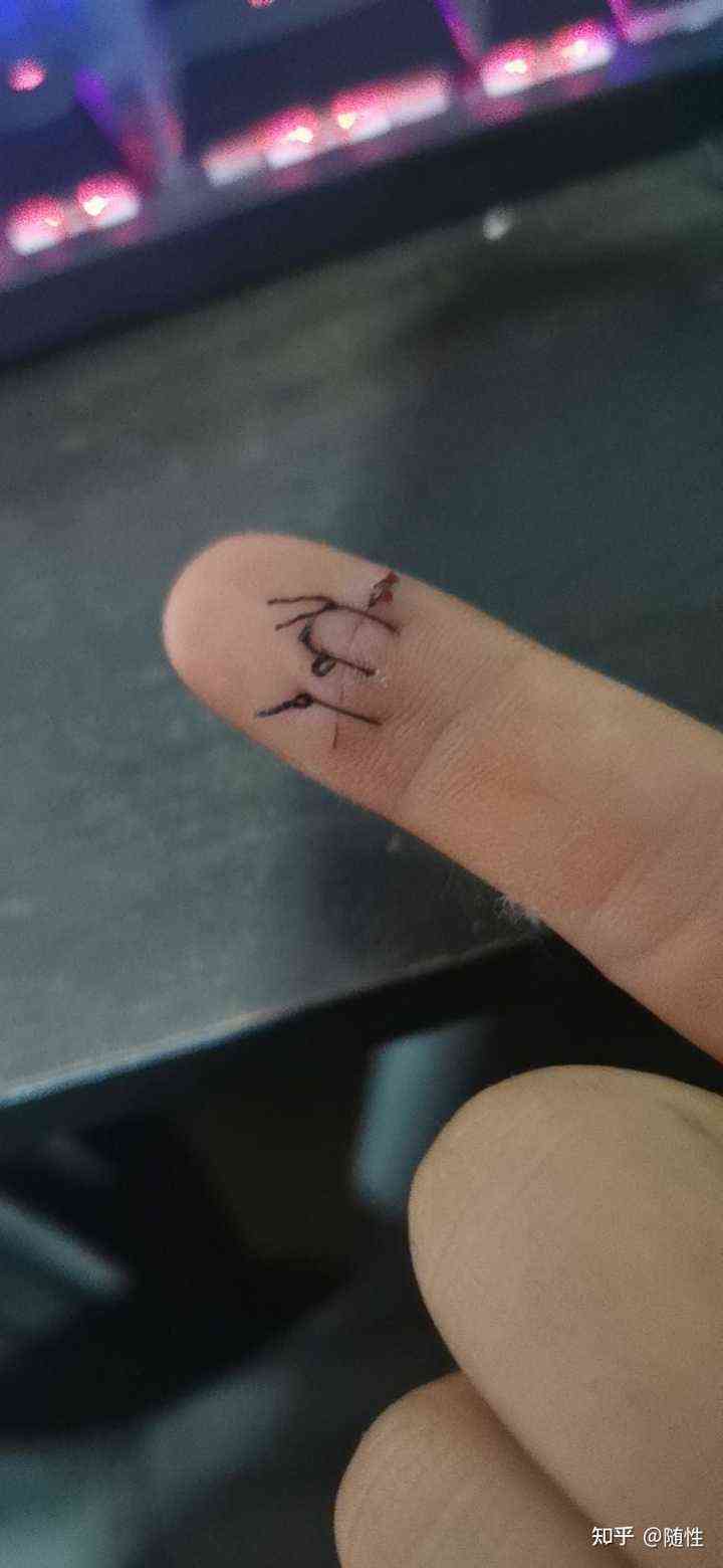 拆线后手指恢复期间如何安排工作与生活