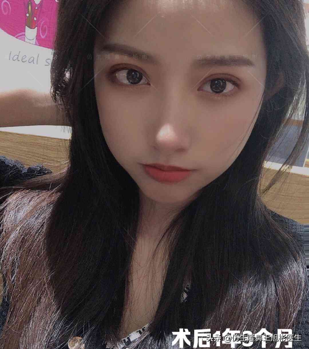 '手指拆线后是否能恢复至术前状态：探讨恢复原样的可能性'