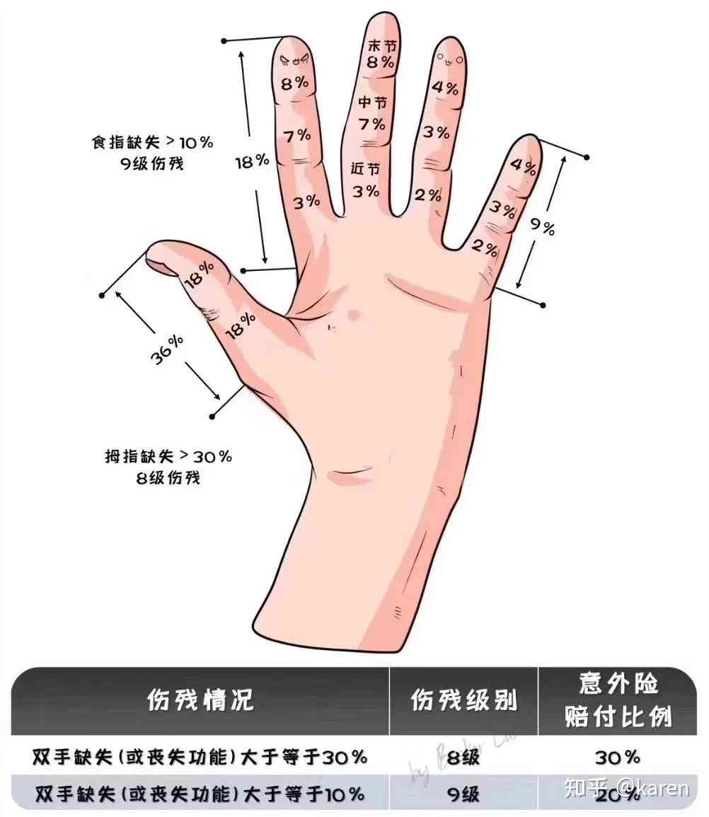 手指断四根怎么认定工伤伤残等级及赔偿标准