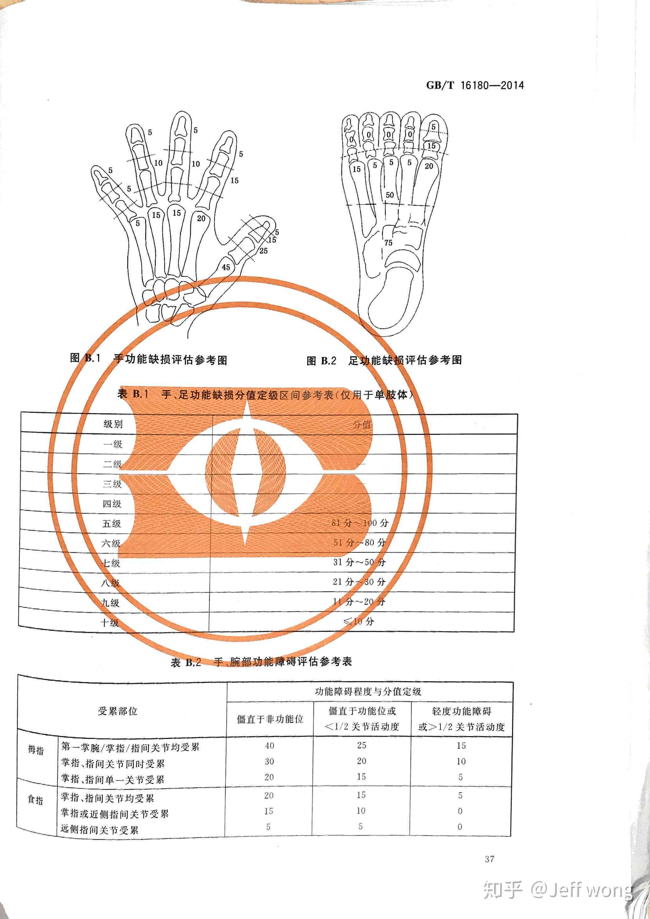 手指骨折伤残等级鉴定标准及详细分级解析