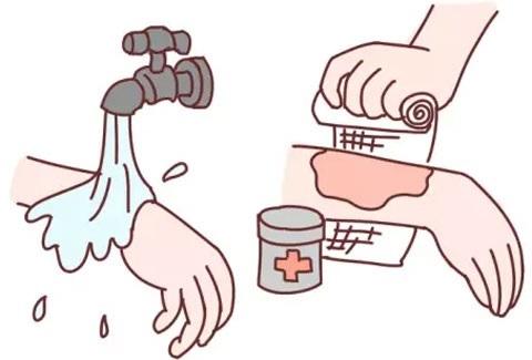 手指烫伤自愈的可能性与护理方法探究