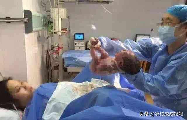 手指电击伤的严重程度评估：截肢是否必要及治疗对策分析
