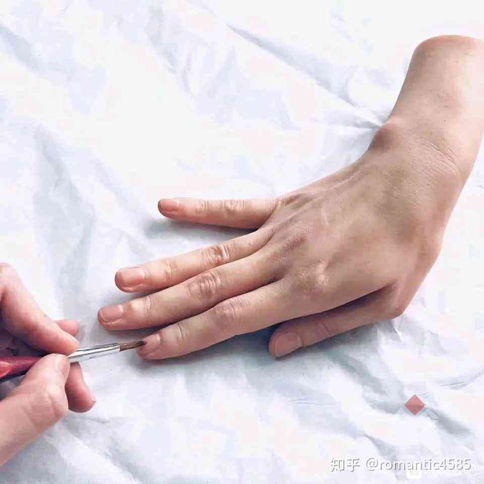 轻微手指骨裂工伤认定标准与处理指南