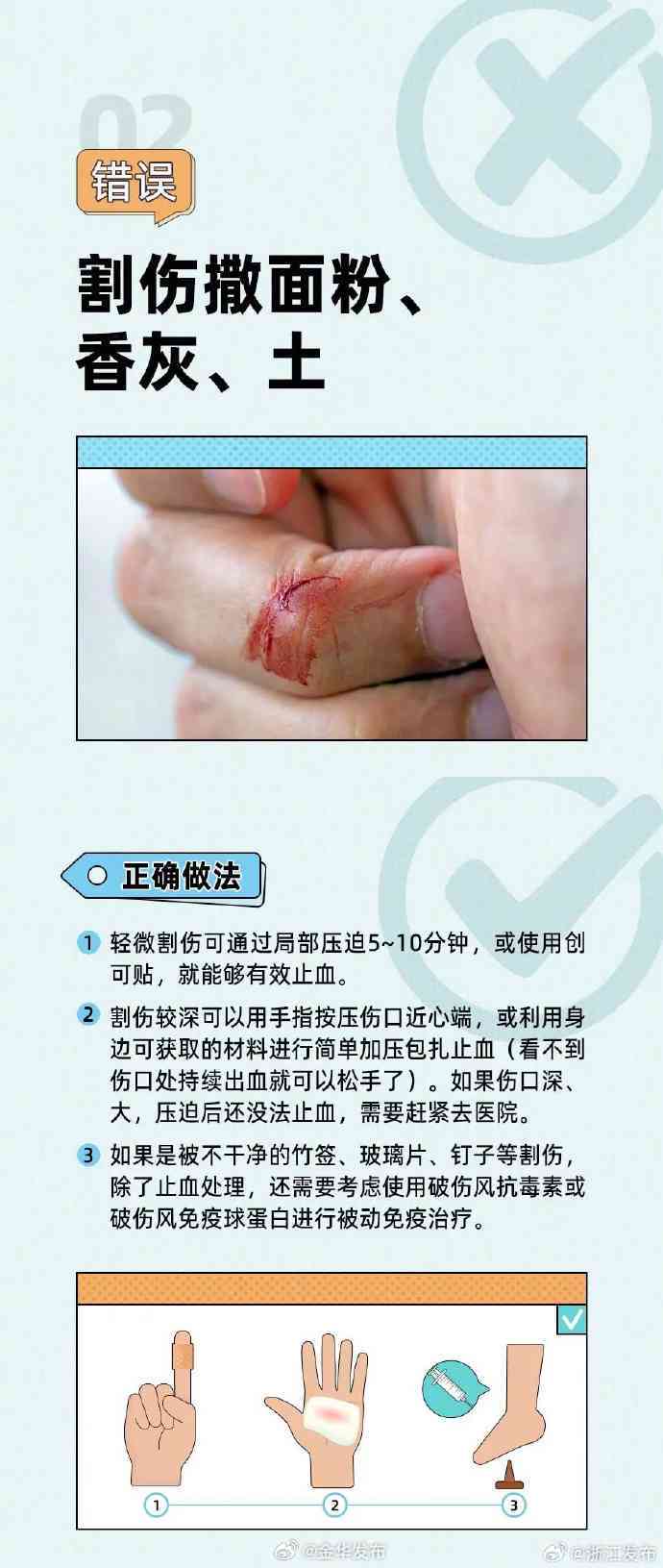 手部挫伤处理指南：日常防范与急救措