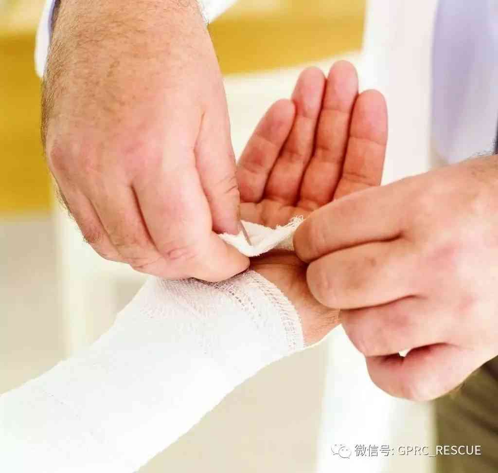 手部挫伤处理指南：日常防范与急救措