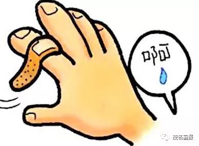 手挫伤一般需要多久恢复：如何加速痊愈时间与完全恢复周期