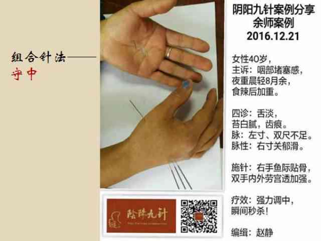 工伤认定：手掌缝合九针案例解析