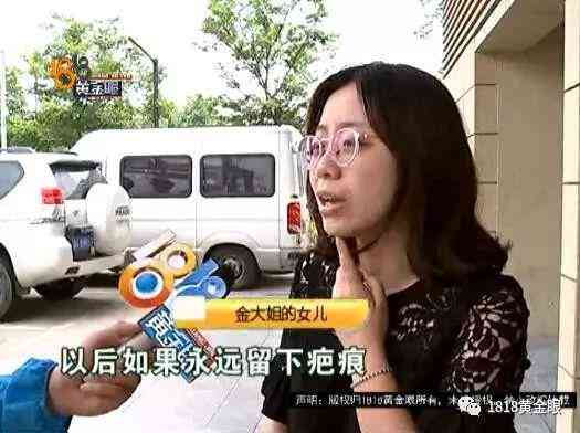 手术疤痕可以做手术去掉吗：手术切除费用及可行性分析