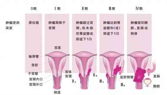 全方位解析：手术疤痕的治疗方法与改善策略