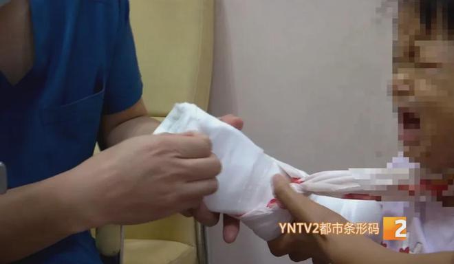 缝针后手指恢复期间：同房行为对伤口愈合的影响