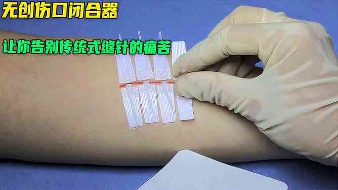 手破了缝针可以认定工伤吗