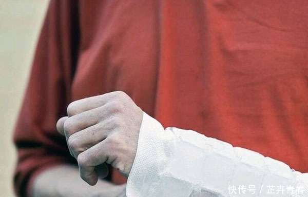手脱臼了可以认定工伤吗赔偿多少及工伤认定标准与赔偿金额解析
