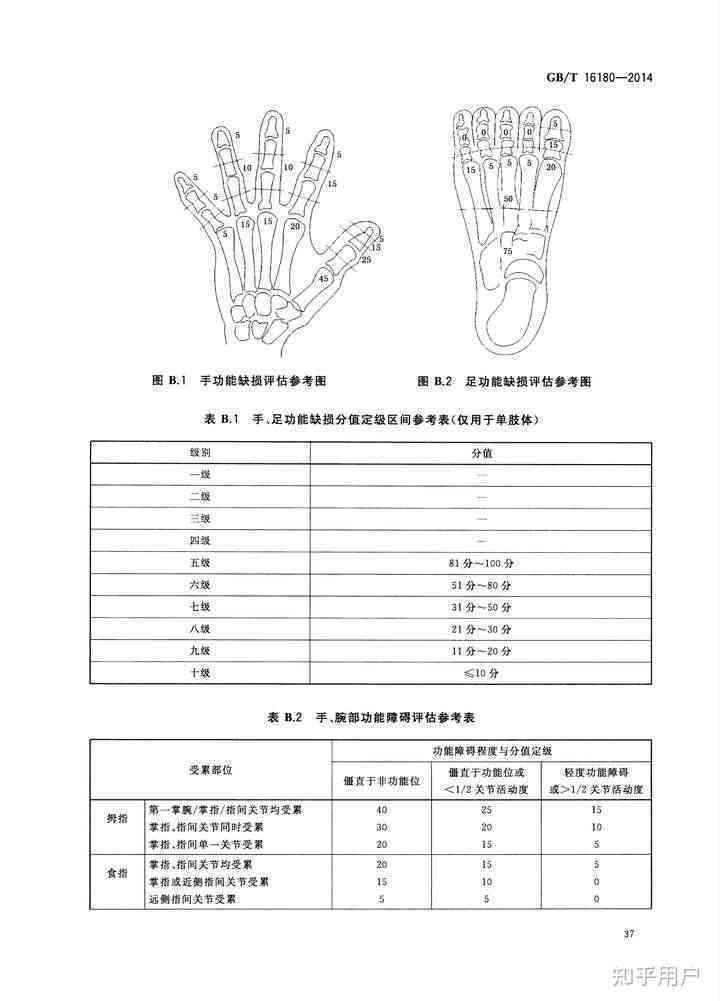 工伤手脱臼伤残等级判定标准及赔偿指南