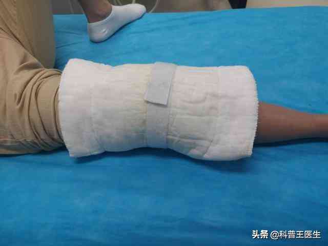 手腕腱鞘炎手术全解析：适应症、术式选择、恢复与费用指南