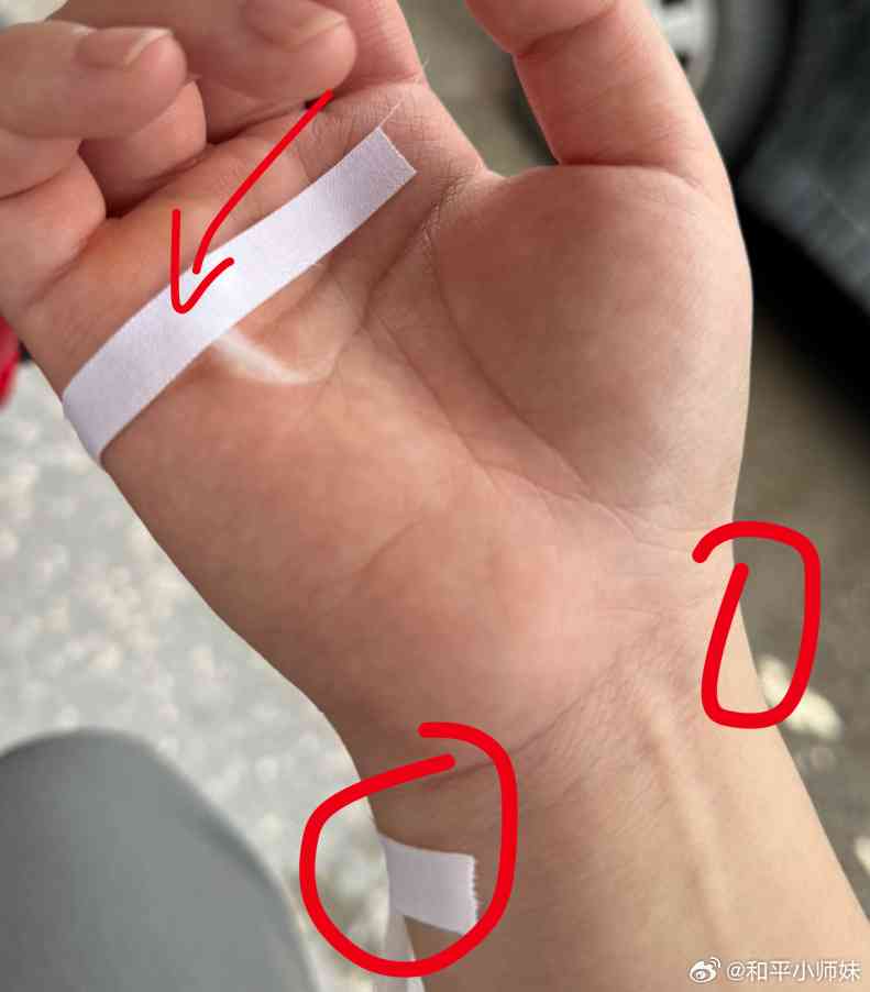 手腕腱鞘炎可以认定工伤吗