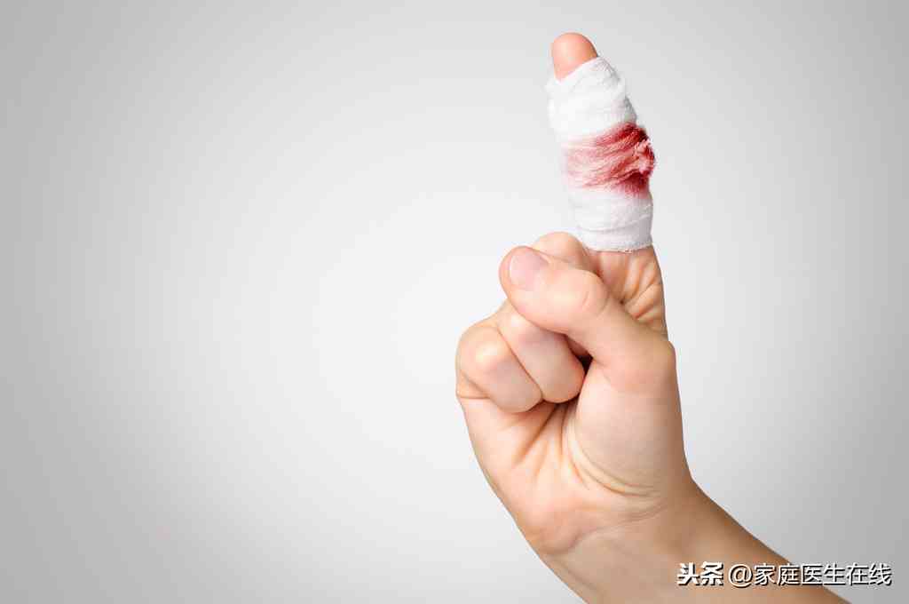 手被砸伤了怎么消肿：最快止痛消肿方法及快速消肿技巧