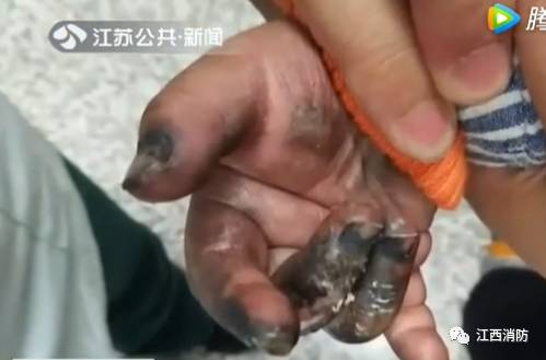 手被酸烧伤能认定工伤吗