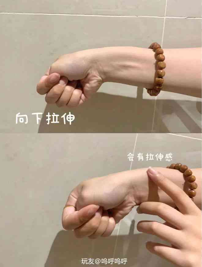 探讨腱鞘炎：它是否被归类为职业病及工作相关工伤？