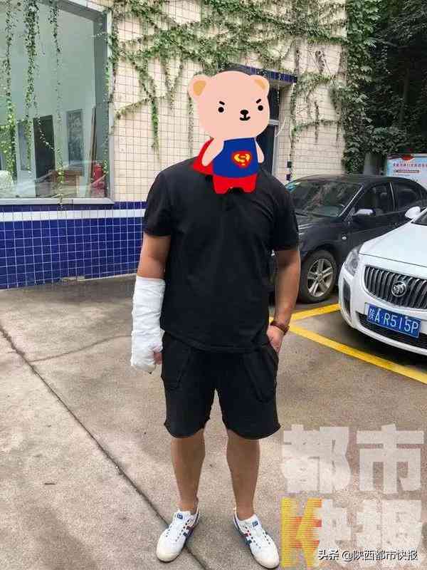工伤认定：手部骨折如何申请赔偿及赔偿标准解析