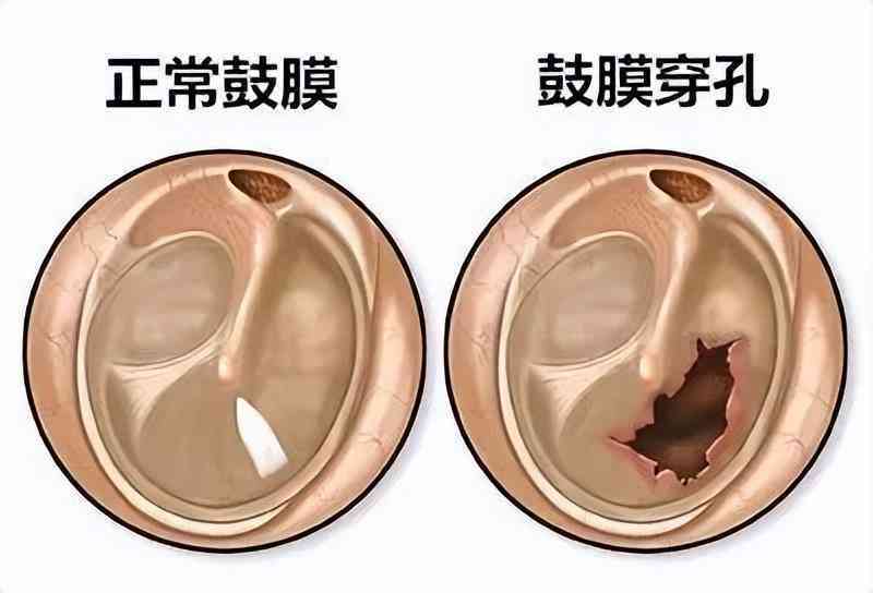 打架致伤如何界定轻伤、重伤与轻微伤：法律标准与鉴定方法全解析