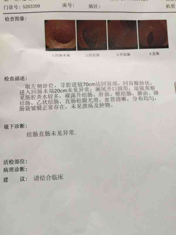 磁共振一般报告多久出来：检查后多久可取报告单及检测结果时长说明